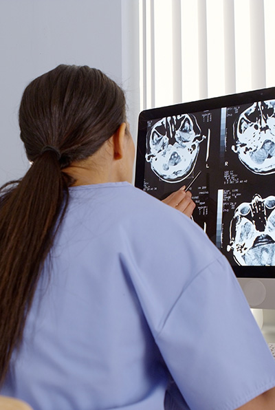 Female radiographer looking at a brain scan
